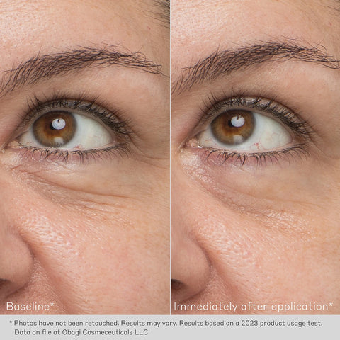 Daily Hydro-Drops Rejuvenating Eye Gel Cream. Before After. Obagi Medical. Worldwide international shipping. Official stockist. UK Ambassador Clinic.