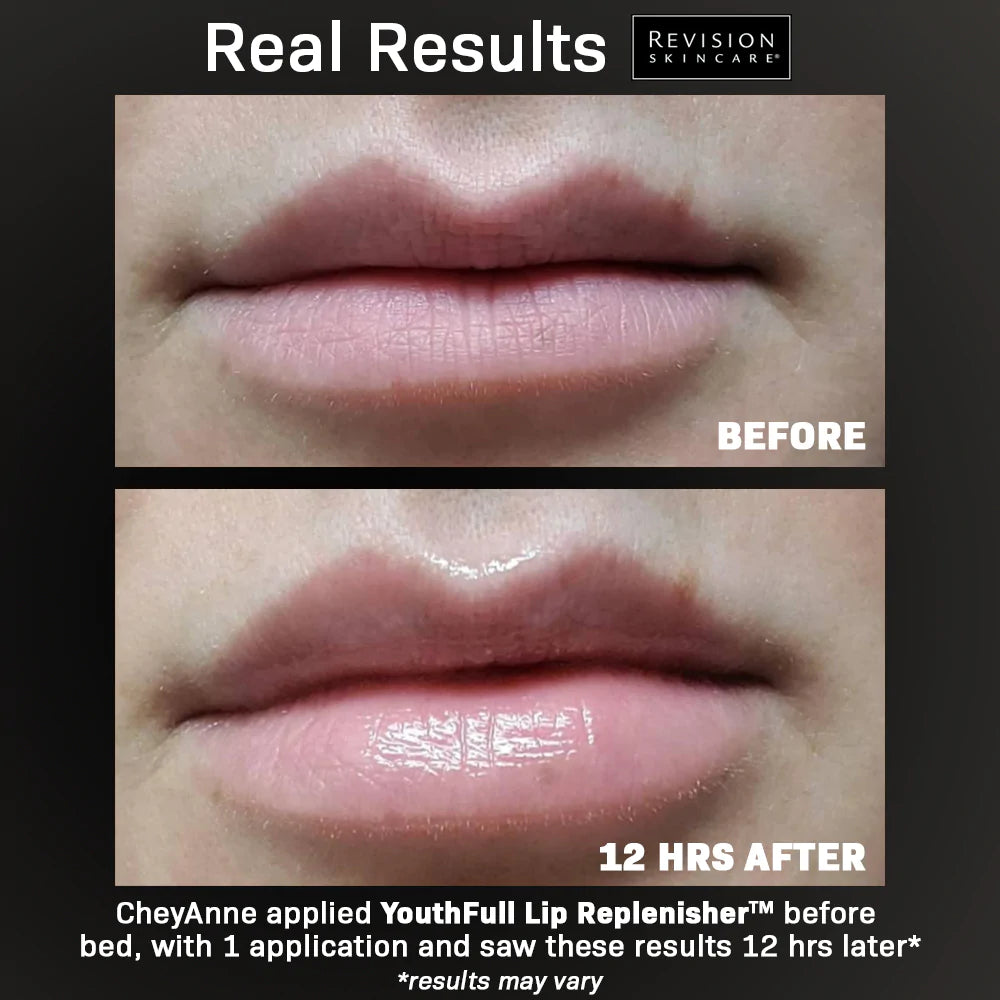 YouthFull Lip Replenisher™ Revision Skincare. Official Stockist. Worldwide shipping. Medical-grade skincare. The M-ethod Aesthetics